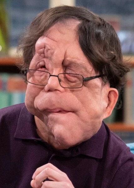 Adam Pearson photo