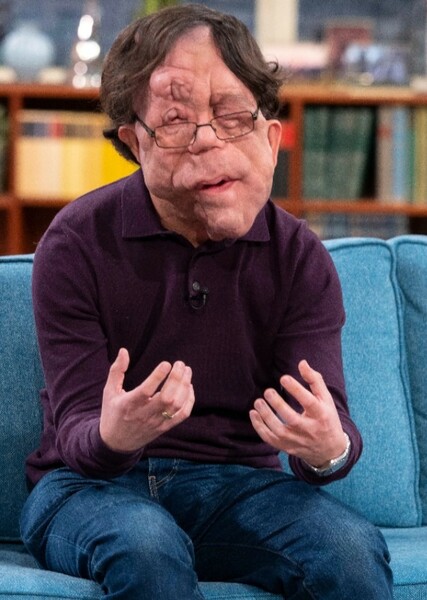 Adam Pearson photo