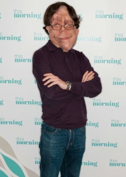 Adam Pearson photo