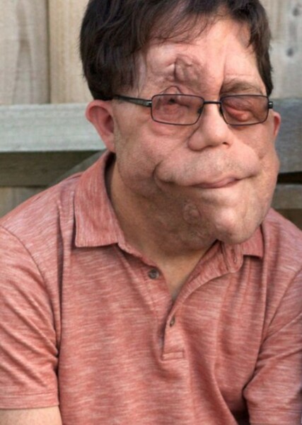 Adam Pearson photo