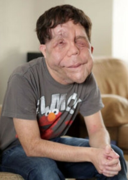 Adam Pearson photo