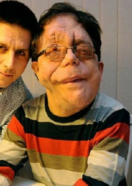 Adam Pearson photo