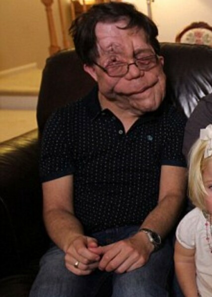 Adam Pearson photo