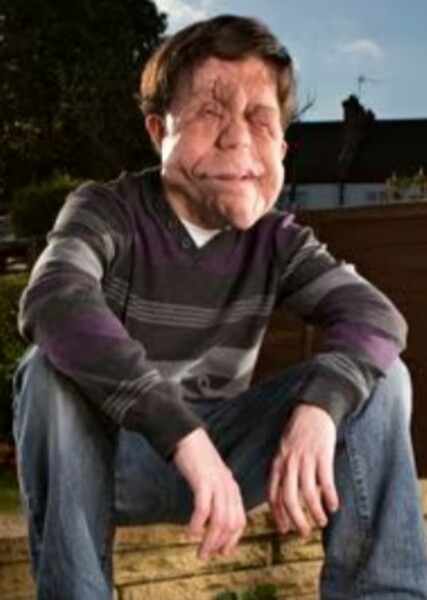 Adam Pearson photo