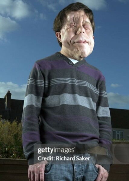 Adam Pearson photo