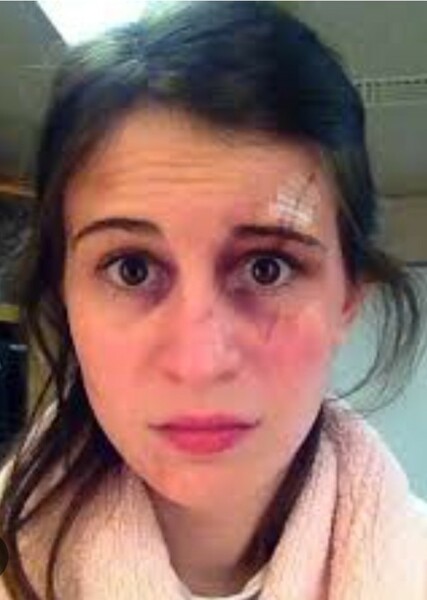 Amelia Rose Blaire photo