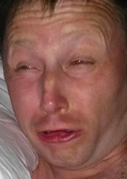 Limmy