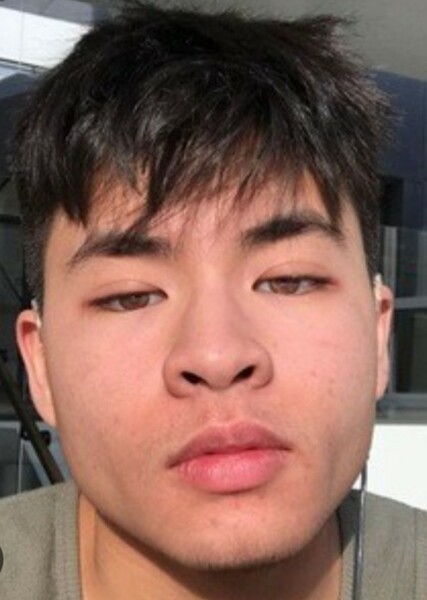 Chella Man photo