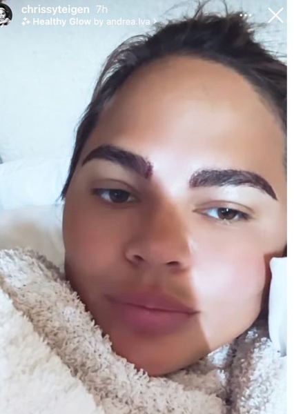 Chrissy Teigen photo