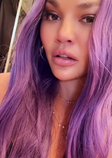 Chrissy Teigen photo