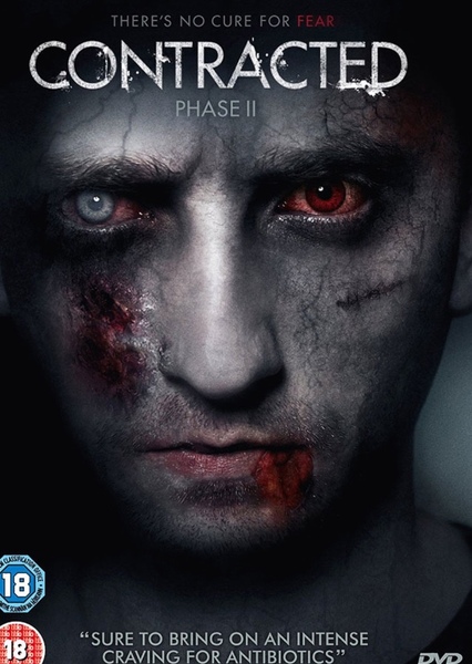 Contracted Phase 2