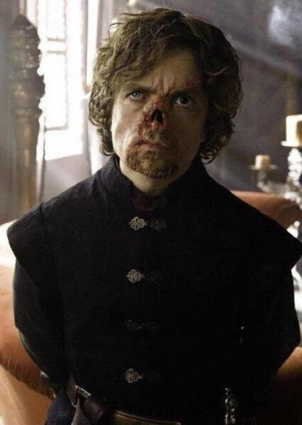 Peter Dinklage photo