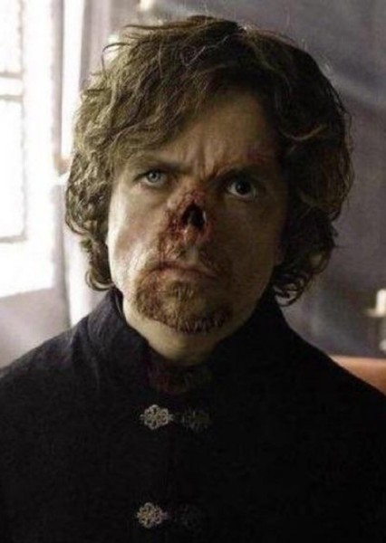 Peter Dinklage photo