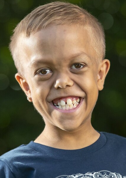 Quaden Bayles photo