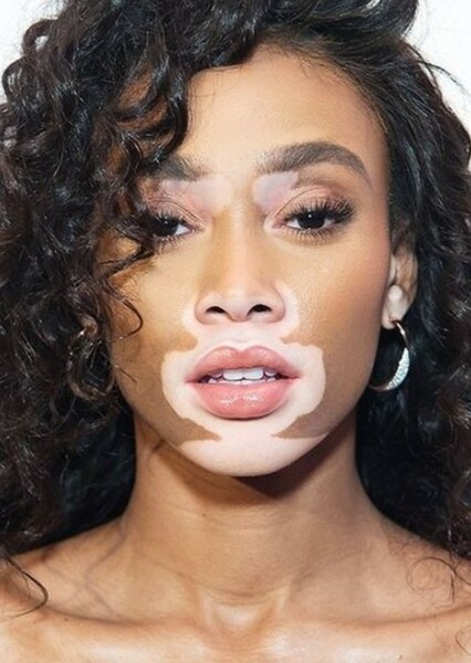 Winnie Harlow photo
