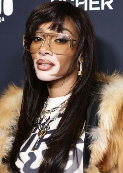 Winnie Harlow