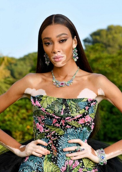 Winnie Harlow photo