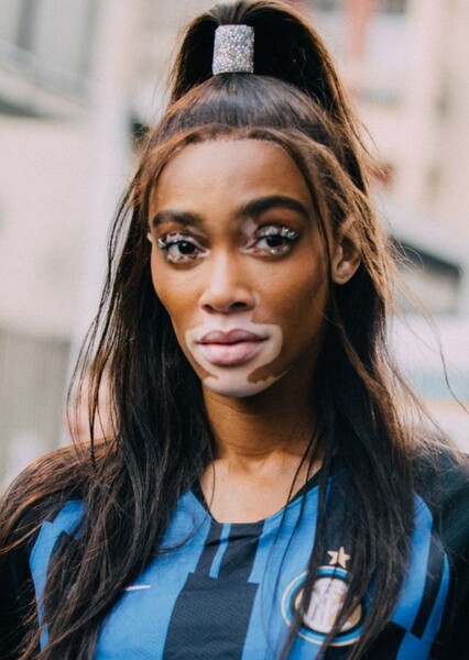 Winnie Harlow photo