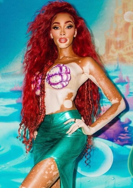 Winnie Harlow photo