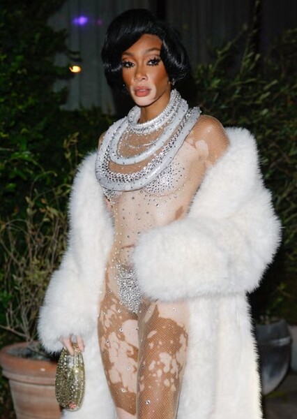 Winnie Harlow photo
