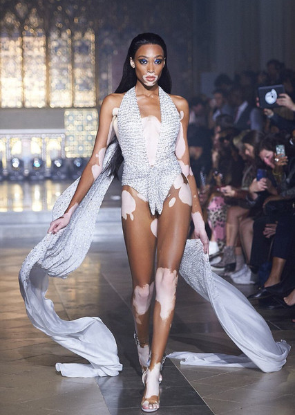 Winnie Harlow photo