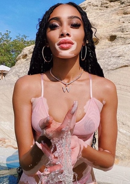 Winnie Harlow