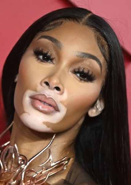 Winnie Harlow