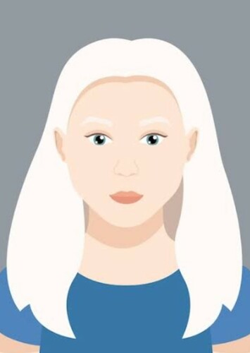 Albinism (F)