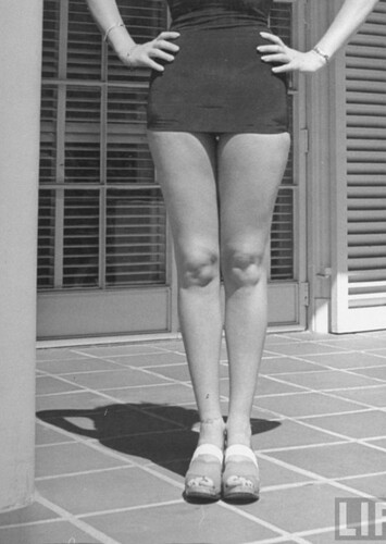 “Legs”