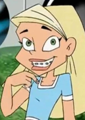Braceface