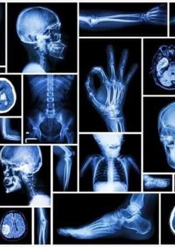 Radiology X-Rays