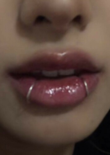 Snake Bites
