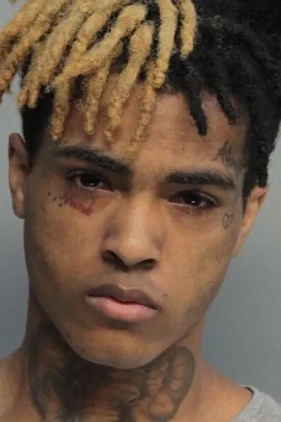 XXXTENTACION
