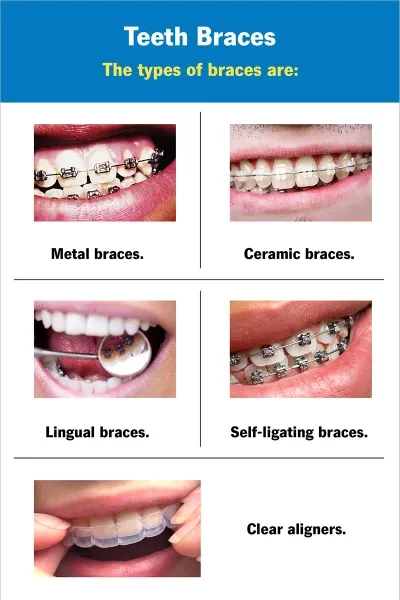 Braces photo 2