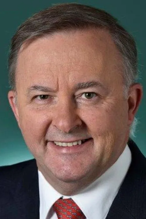Anthony Albanese photo