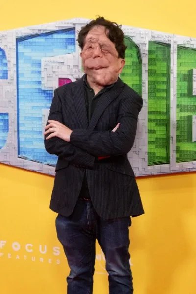 Adam Pearson photo