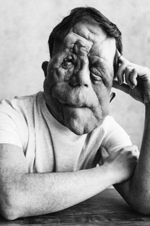 Adam Pearson photo