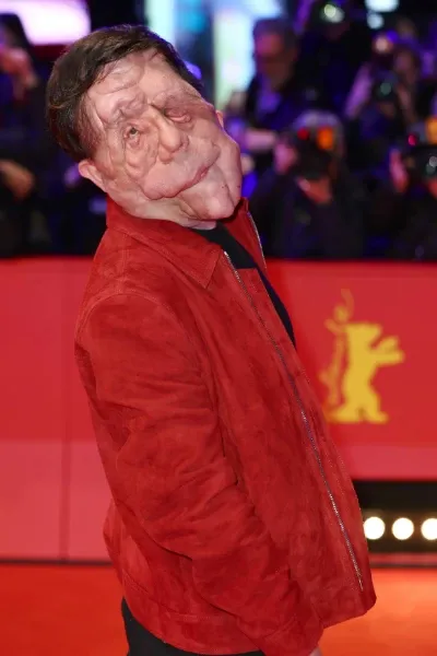 Adam Pearson photo