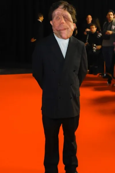 Adam Pearson photo