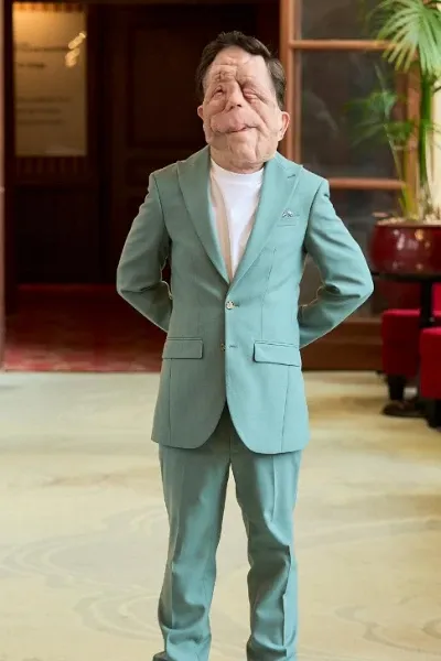 Adam Pearson photo