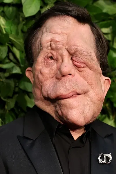Adam Pearson photo