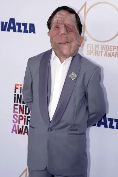 Adam Pearson photo