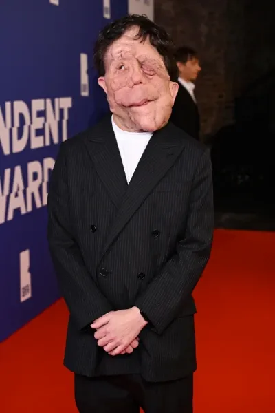 Adam Pearson photo