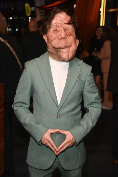 Adam Pearson photo