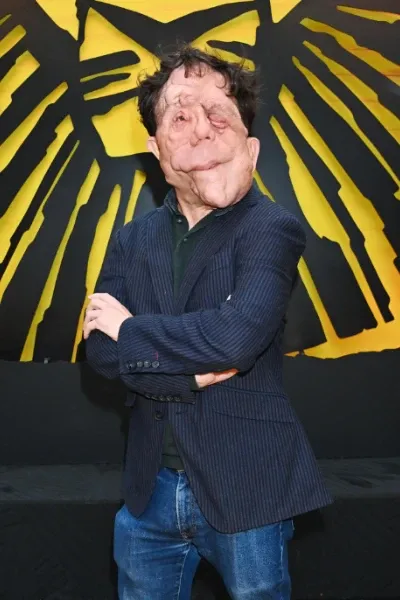 Adam Pearson photo