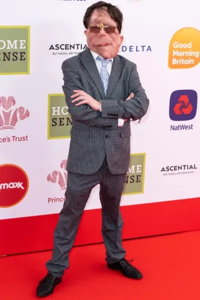Adam Pearson photo