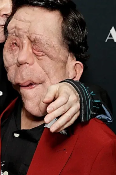 Adam Pearson photo