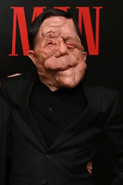 Adam Pearson photo