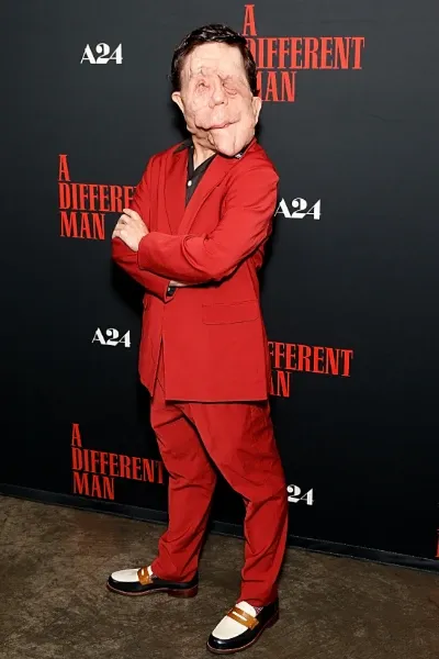 Adam Pearson photo