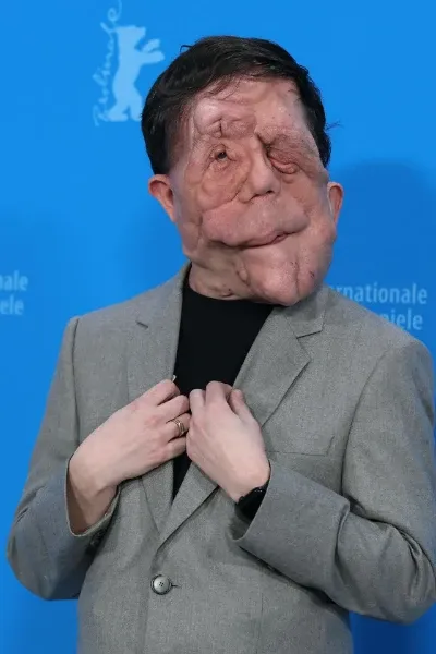 Adam Pearson photo